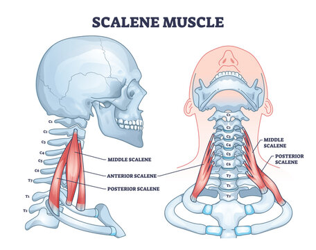 Scalene muscle structure with medical location on neck outline diagram. Labeled educational anatomical sprain scheme with middle, anterior and posterior parts of muscular system vector illustration.