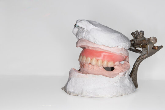 Semi-adjustable articulator with wax model for tooth try-in prior to denture fabrication on white background with space for text