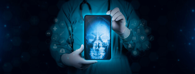 The doctor holds a tablet and examines a posteroanterior (PA) x-ray of the paranasal sinuses. The doctor analyzes the frontal and ethmoid sinuses. Technological digital background - obrazy, fototapety, plakaty