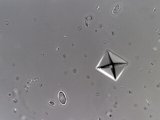 Calcium oxalate crystal from urine sediment.