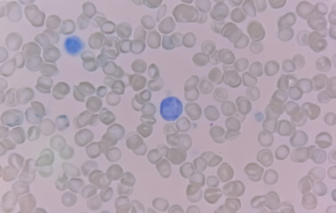 Close view of Reticulocyte count under microscope, 40x. methylene blue staining