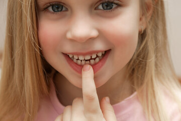 Cute preschool girl showing a loose primary (baby) tooth 