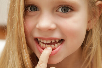 Cute preschool girl showing a loose primary (baby) tooth 