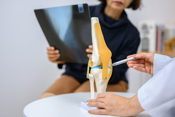 Orthopedic surgeon explains treatment of cruciate ligament injury to patient with knee bone model.