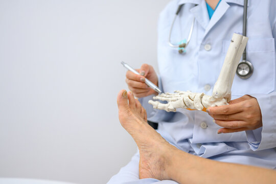 An orthopedic doctor holding a model of ankle and foot bones is explaining to a patient foot bone problems. Concept of health care for feet and foot bones