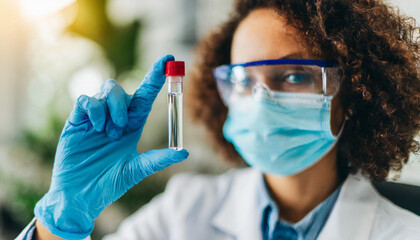 Scientist's hand grips a sample tube, symbolizing precision and discovery, with a blurred laboratory backdrop