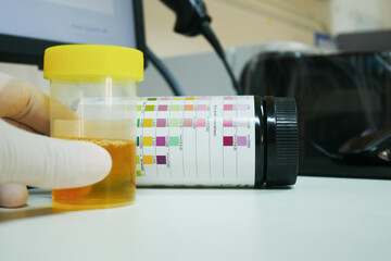 Urine analysis in laboratory.