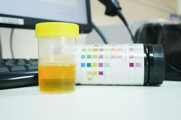 Urine analysis in laboratory.