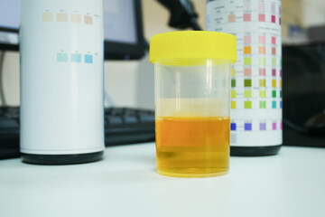 Urine analysis in laboratory.