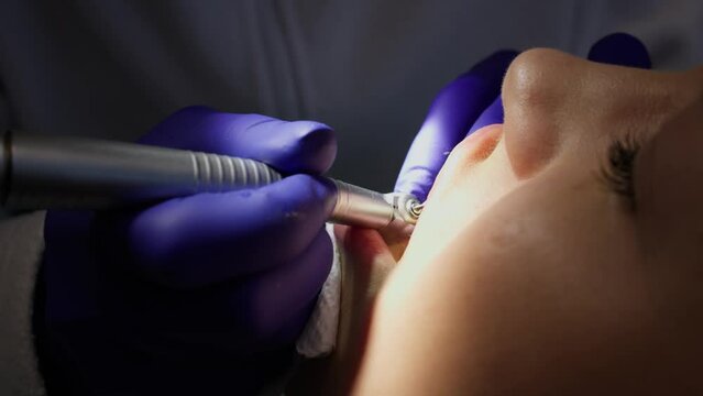 Process of teeth cleaning or treatment with dental clinic close-up. Installation of veneers or teeth cleaning in modern dentistry.