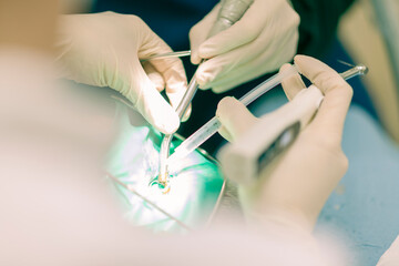 Detail of a dentist performing surgery with anesthesia on a patient for root canal treatment and regeneration. No people are recognizable. - 727125359
