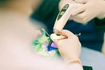Detail of a dentist performing surgery with anesthesia on a patient for root canal treatment and regeneration. No people are recognizable. - 727125395