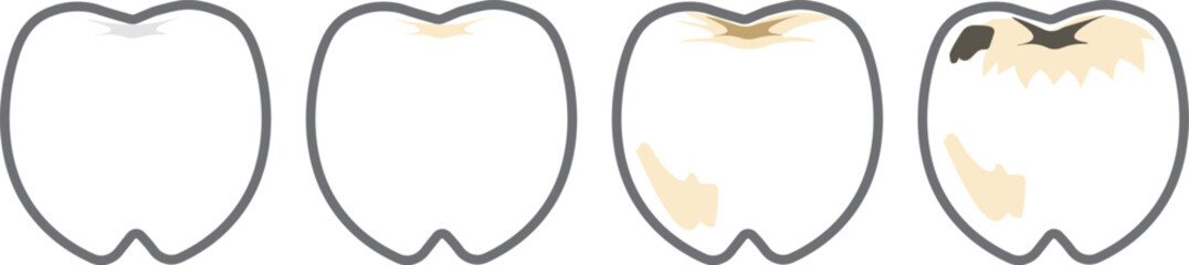 キラキラときれいな歯