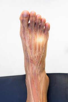 Orthopedic doctor or surgeon examined the patient with numbness of foot.Foot pain in Morton neuroma syndrome with transparent anatomy of nerve.Light effect on white background.Foot numbness and pain.