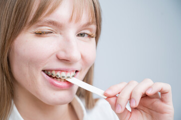 A smiling woman with metal braces on her teeth chews gum.