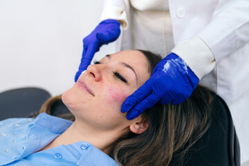 Aesthetic professional gently massages a client's cheek to soothe the area after a hyaluronic acid filler injection.