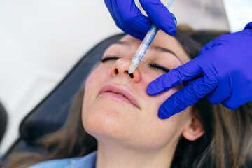 Aesthetic clinic provides a hyaluronic acid lip injection, aiming for fuller lips with a meticulous...
