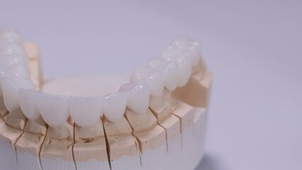 Artificial jaw mold with dental crowns, rotating on white background. Dental prosthesis, artificial tooth, prosthetic. Dental implants, Modern dentist technology.
