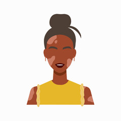 World vitiligo day concept. Portrait of a woman with vitiligo skin depigmentation. Body positive and inclusivity illustration