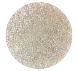 Photomicrograph of Sickle cell anemia, sickling test. Sickle cell disease (SCD)