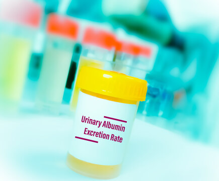 Container isolated with test order Albumin excretion, to diagnose kidney disease