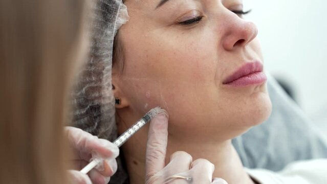 Beautician doctor makes botox injection in the cheekbone of young beautiful woman. Extreme close up 4k shot