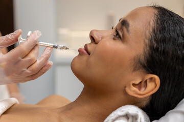 Dark-skinned woman having hyaluronic acid injection into lips
