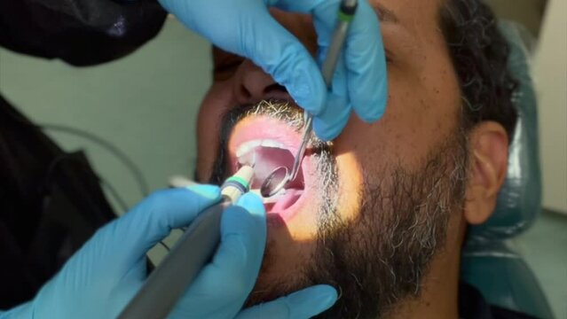 In a well lit dental office, a close-up view of a mixed race, middle aged man with a beard at the dentist. He is getting his teeth cleaned by a dental hygienist. She is wearing blue latex gloves.