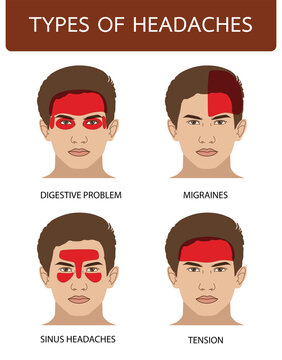 Types of headaches migraine, sinus, tension, digestive, illustration on white background
