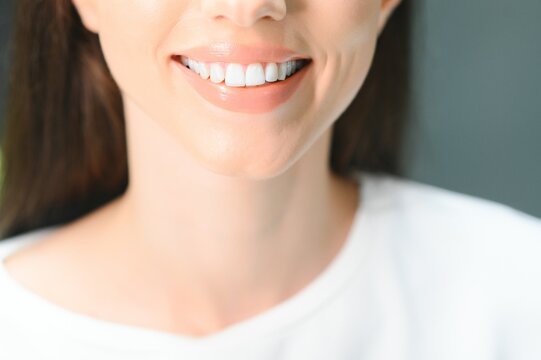 Beautiful Smile With White Teeth. Closeup Of Smiling Woman Mouth With Natural Plump Full Lips And Healthy Perfect Smile