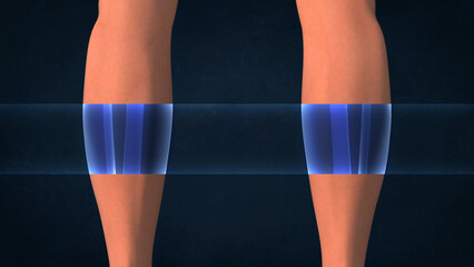 An X-ray of a human calf 