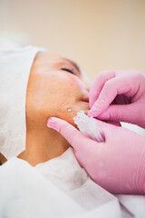 A woman undergoes a thread lifting procedure to correct her facial skin - skin tightening