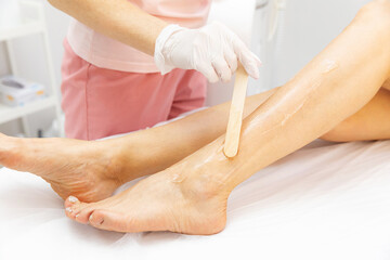 Cosmetologist applies gel to woman's legs for laser hair removal. Beautician doing laser...