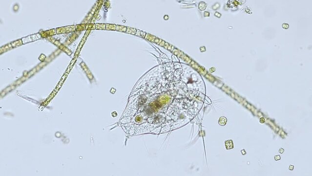 Nauplius larva of a cyclop (copepod) under the microscope