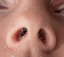 Fototapeta premium The girl's nose is in the snow. Macro