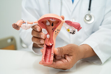 Uterus, doctor with anatomy model for study diagnosis and treatment in hospital.