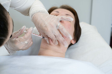 Expert administers lipolytics, reshaping the chin area. Emphasizes the blend of health, beauty, and...