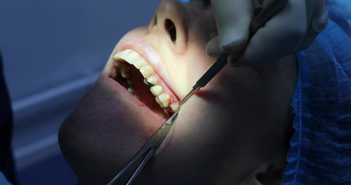 Face of patient, hands of stomatologist sutured wound after tooth extraction