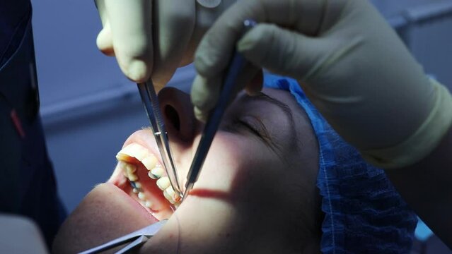 Face of patient, hands of dentist sutured wound after tooth extraction and assistant 