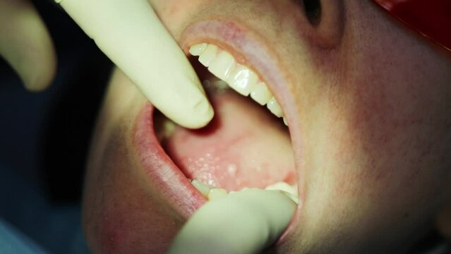 Dentist hands in gloves inspect woman jaw in clinic