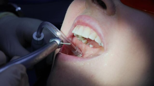 Dentist puts saliva sucker in mouth and bores tooth after patient bites indicator paper