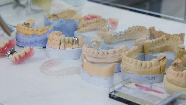  Many different dental models are on shelve in dental clinic