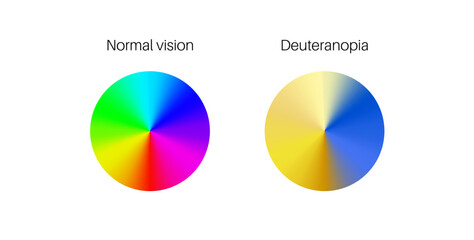 Deuteranomaly and deuteranopia