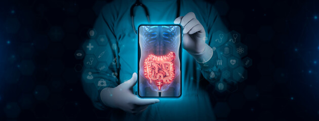 Color image of the large and small intestine on an x-ray. The doctor studies and analyzes the...