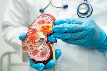 Kidney disease, Chronic kidney disease ckd, Doctor with human model to study and treat in hospital.