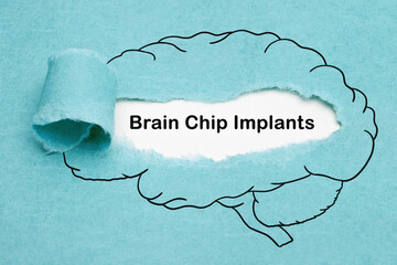 Brain Chip Implants Technology Concept