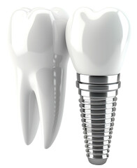 Tooth and dental implant isolated on transparent background. PNG
