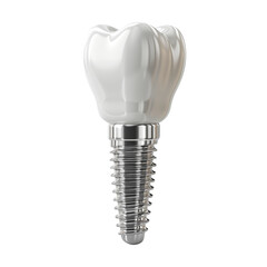 Dental implant isolated on transparent background. PNG