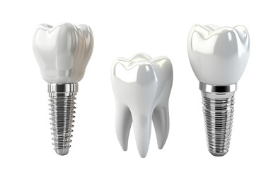 Tooth and dental implant isolated on transparent background. PNG