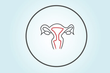 Gynecologists diagnose and treat menstrual disorders such as irregular periods, heavy menstrual bleeding